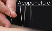 Acupuncture